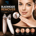 Blackhead Remover Vacuum, Pore Cleaner & Acne Removal Tool